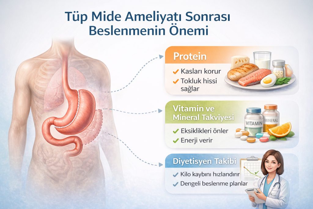 Tüp Mide Ameliyatı Sonrası Beslenmenin Önemi